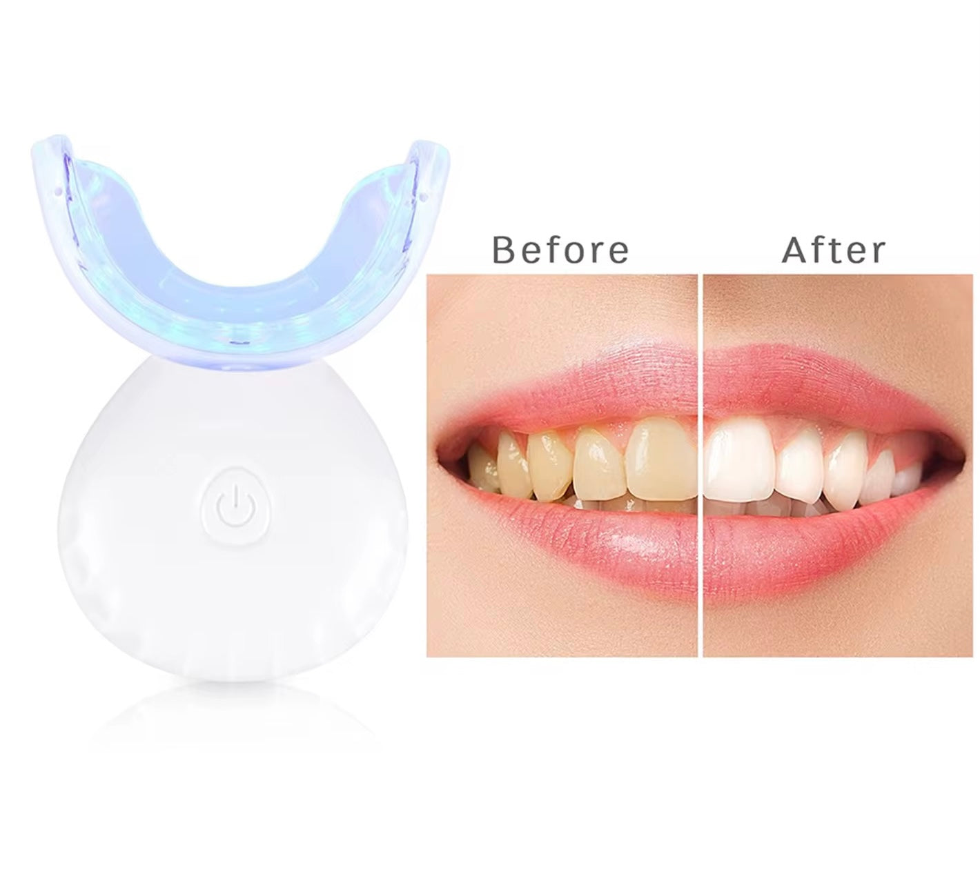 Teeth Whitening System